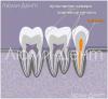 Kako pronaći i liječiti zubne kanale u Lumidentu