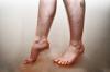 Povreda protoka krvi u nogama: uzroci, simptomi