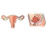 Što se događa u maternici prije i nakon poroda: ono što treba anketu