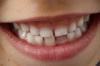 Kako naučiti dijete četkati zube: TOP-3 savjeta