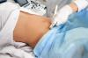 Koliko često trebate raditi ultrazvuk tijekom trudnoće, kaže liječnik