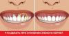 Kako liječiti desni kada zubi postaju goli vrat?